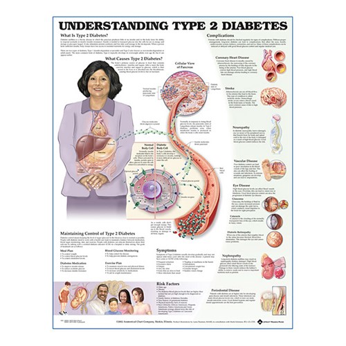 Understanding Typ2 Diabetes plastlaminerad anatomisk plansch